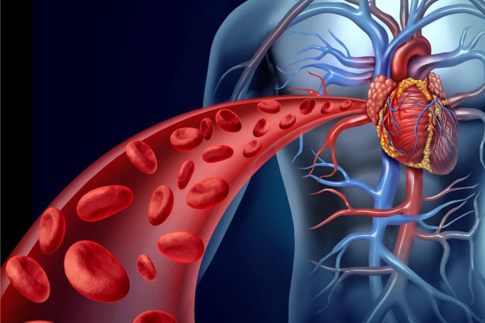 Cardiopatia ischemica